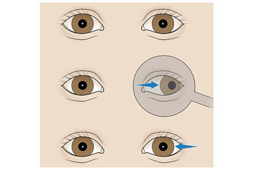 test ocular 12 linii